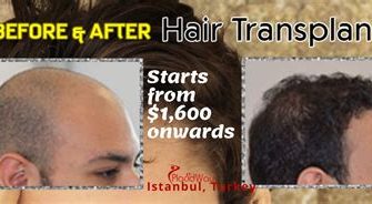 Do I need to cover my hair in Istanbul?