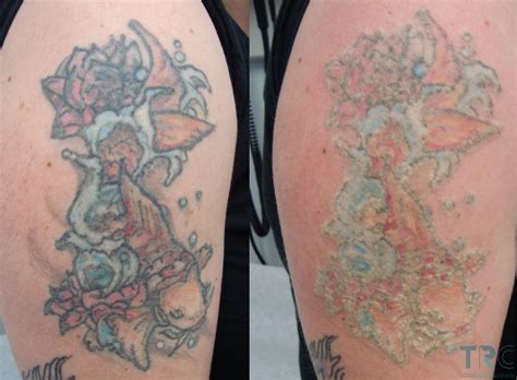 Which Tattoo Colors Fade The Fastest?